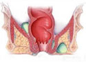 迟大夫讲肛周脓肿预防与护理